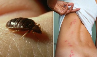 Bed Bug Removal: How To Get Rid Of These Pests?