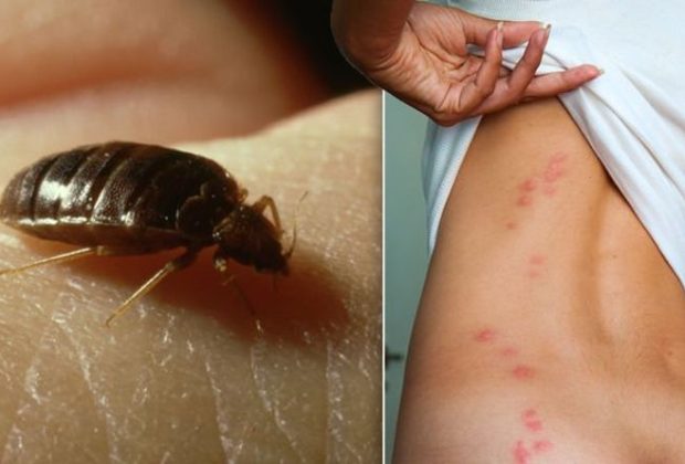 Bed Bug Removal: How To Get Rid Of These Pests?