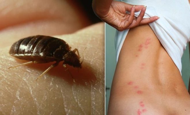 Bed Bug Removal: How To Get Rid Of These Pests?